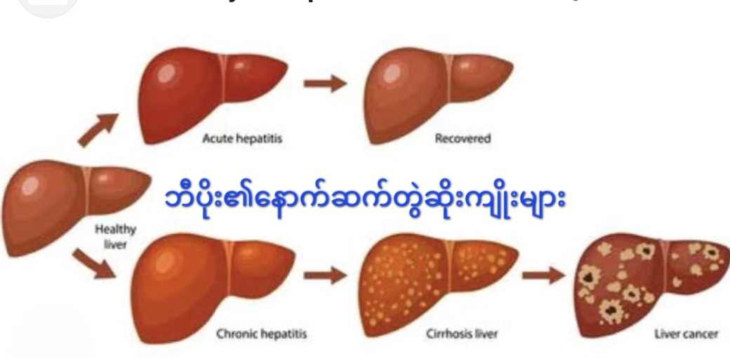 Hepatitis B infection and Its' vaccine