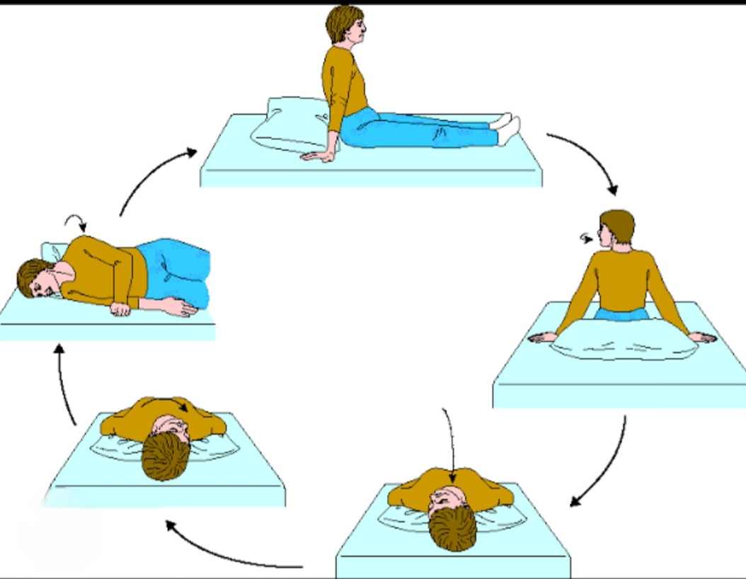 Benign paroxysmal positional vertigo